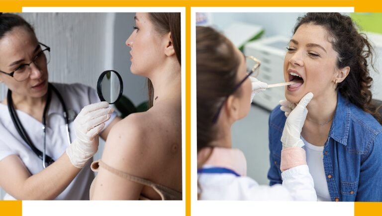 Rastreio gratuito de cancro da pele e oral realiza-se hoje em Cuba